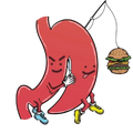 Gastric Sleeve Operation