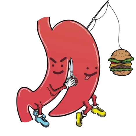 Gastric Sleeve Operation